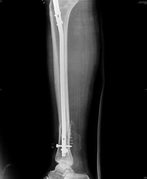 ORTHOPEDIC CLINIC- MAGNA CLINICS Image 4