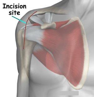 Ortho Neuro Chiropractic Physiotherapy Clinic Image 8
