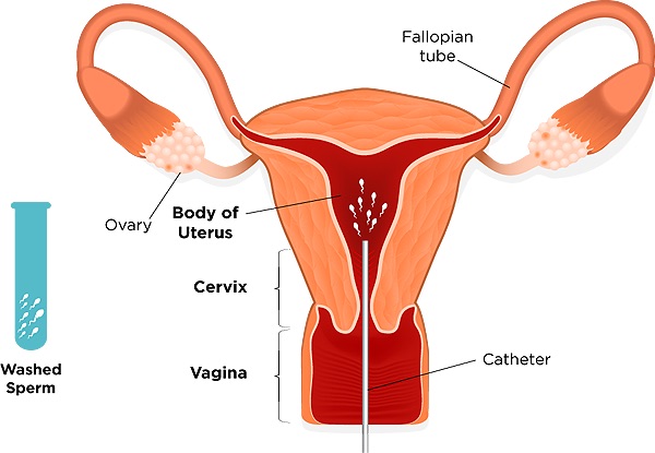Aradhana Test Tube Baby Centre Image 2