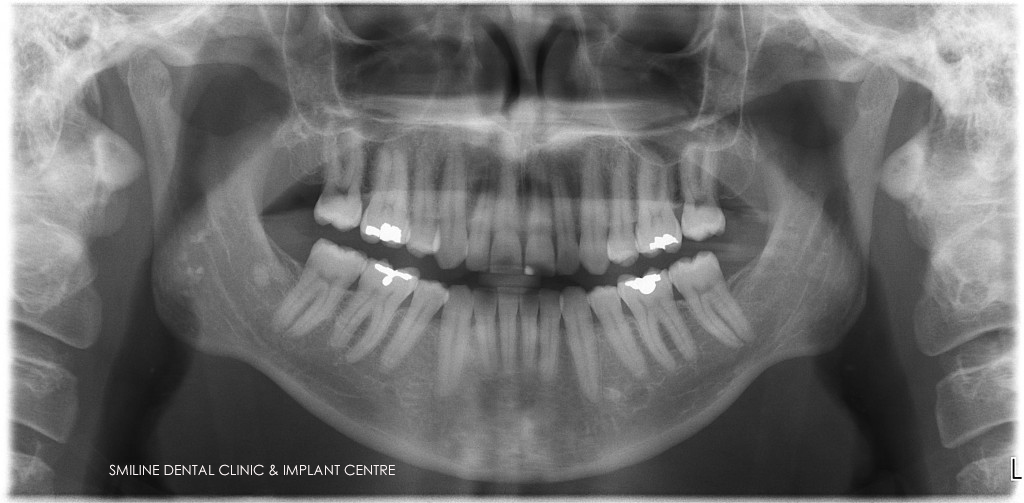 Smiline Dental Clinic & Implant Centre Image 9