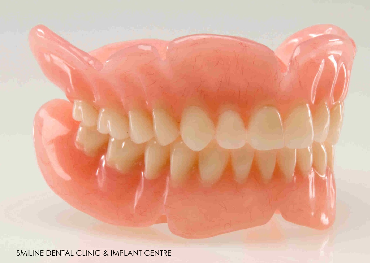 Smiline Dental Clinic & Implant Centre Image 8