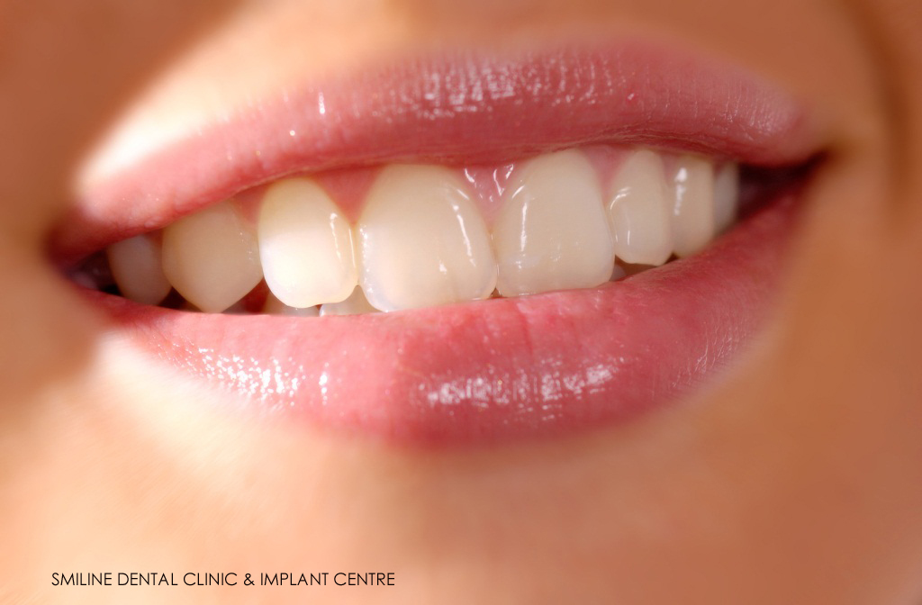 Smiline Dental Clinic & Implant Centre Image 10