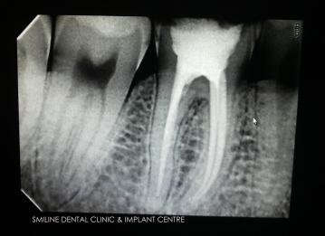 Smiline Dental Clinic & Implant Centre Image 7