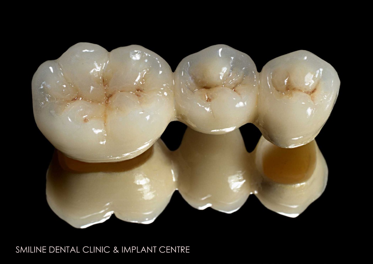 Smiline Dental Clinic & Implant Centre Image 3
