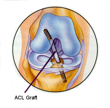 sunanda Arthroscopy and Sports medicine Clinic Image 4