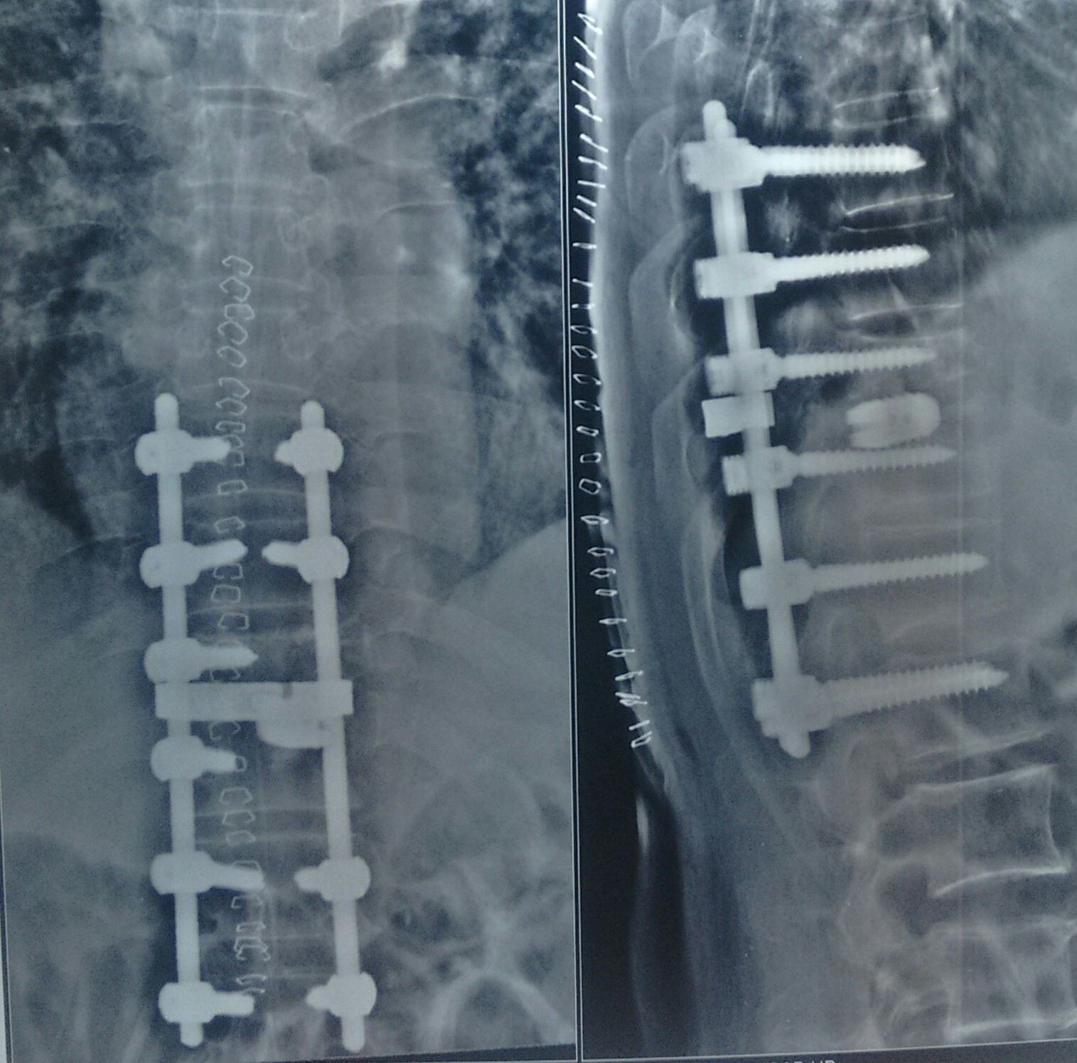 Jaypee Hospital Image 4