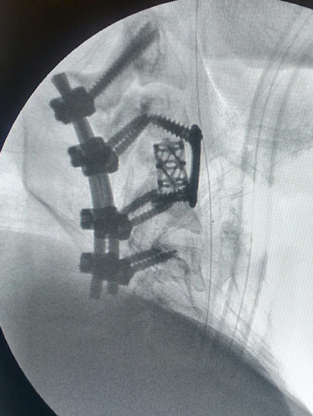 Jaypee Hospital Image 3