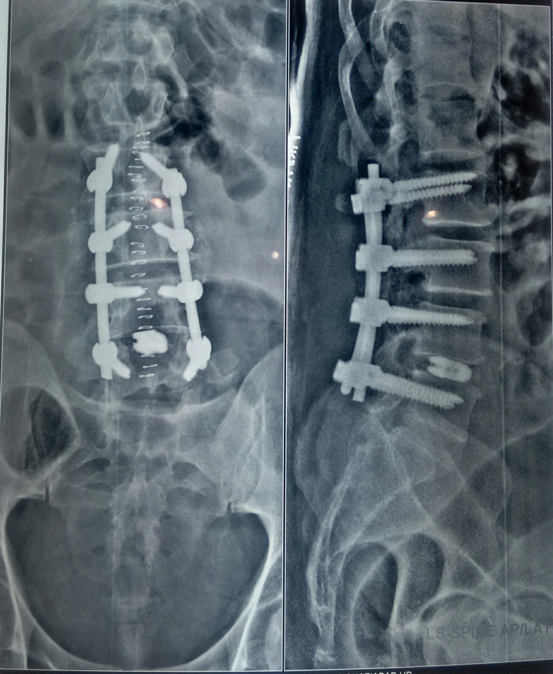 Jaypee Hospital Image 5
