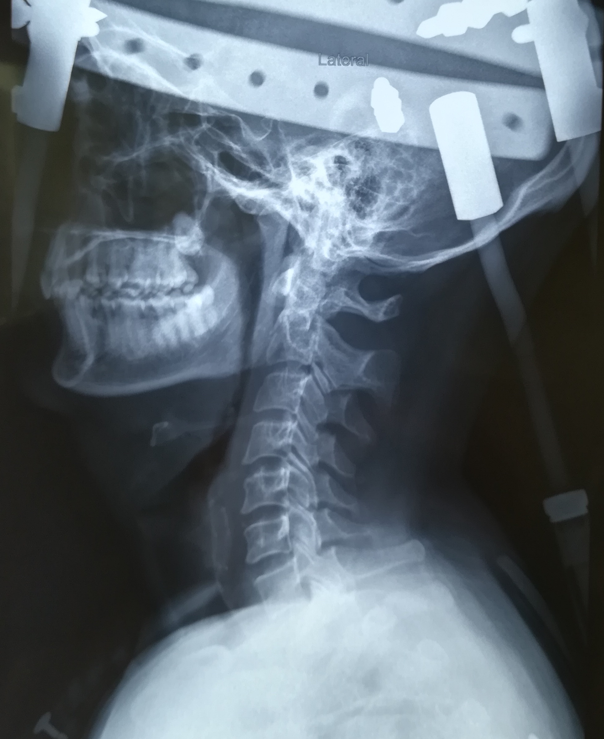 Jaypee Hospital Image 6