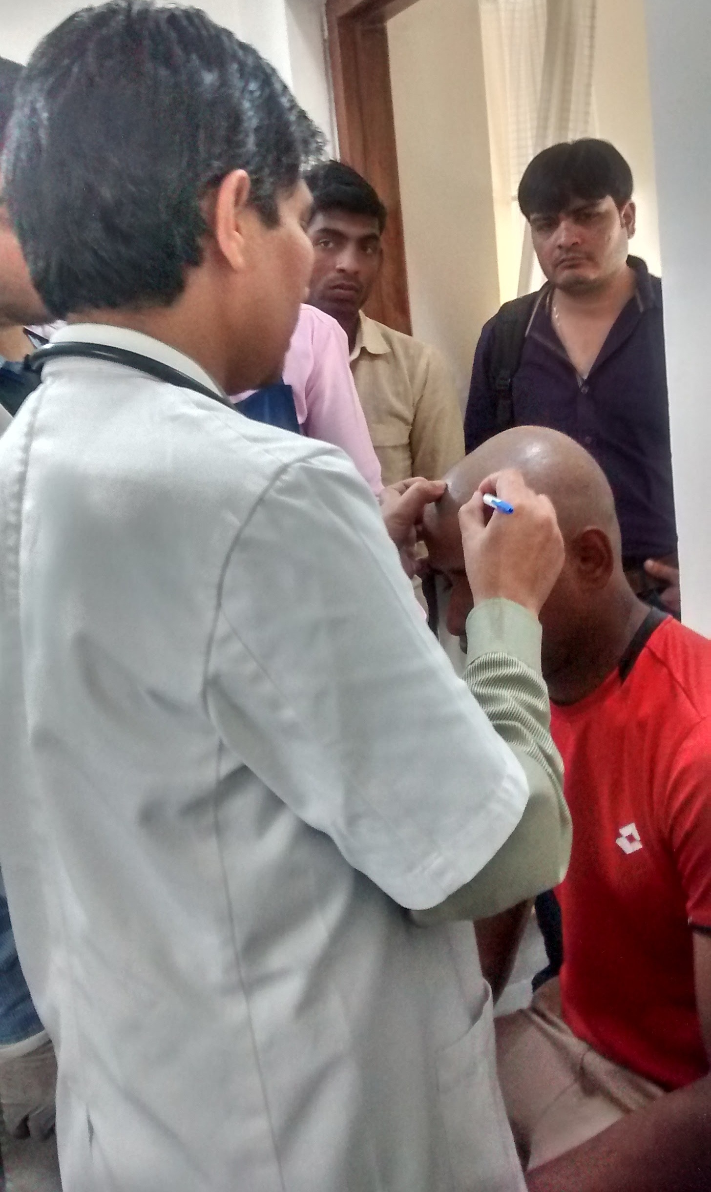 Cupping therapy in Delhi Image 5
