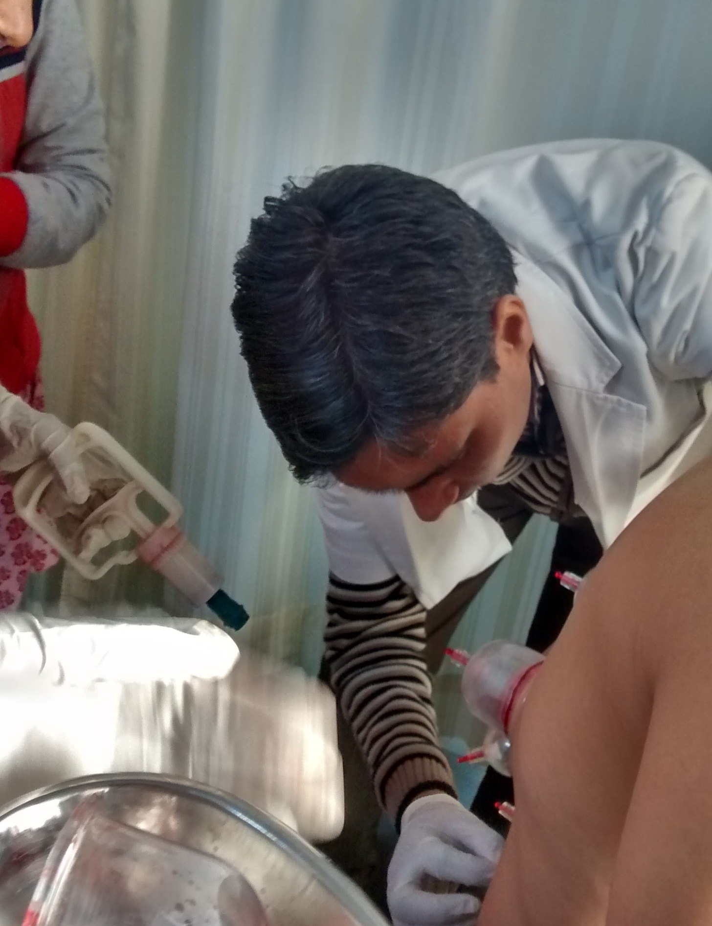 Cupping therapy in Delhi Image 1