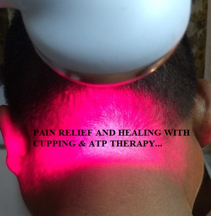 Cupping therapy in Delhi Image 9