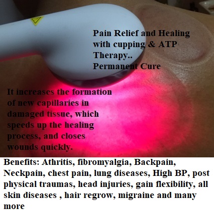 Cupping therapy in Delhi Image 10