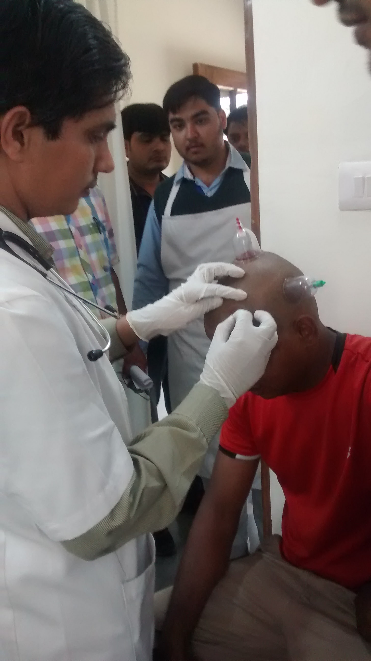 Cupping therapy in Delhi Image 1