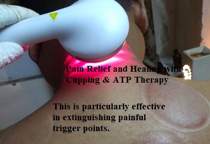 Cupping therapy in Delhi Image 8