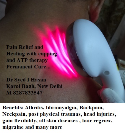 Cupping therapy in Delhi Image 7