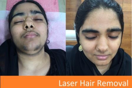 Dr. KULDEEP SINGH SKIN HAIR CLINIC & AMERICAN HAIR TRANSPLANT CLINIC Image 8