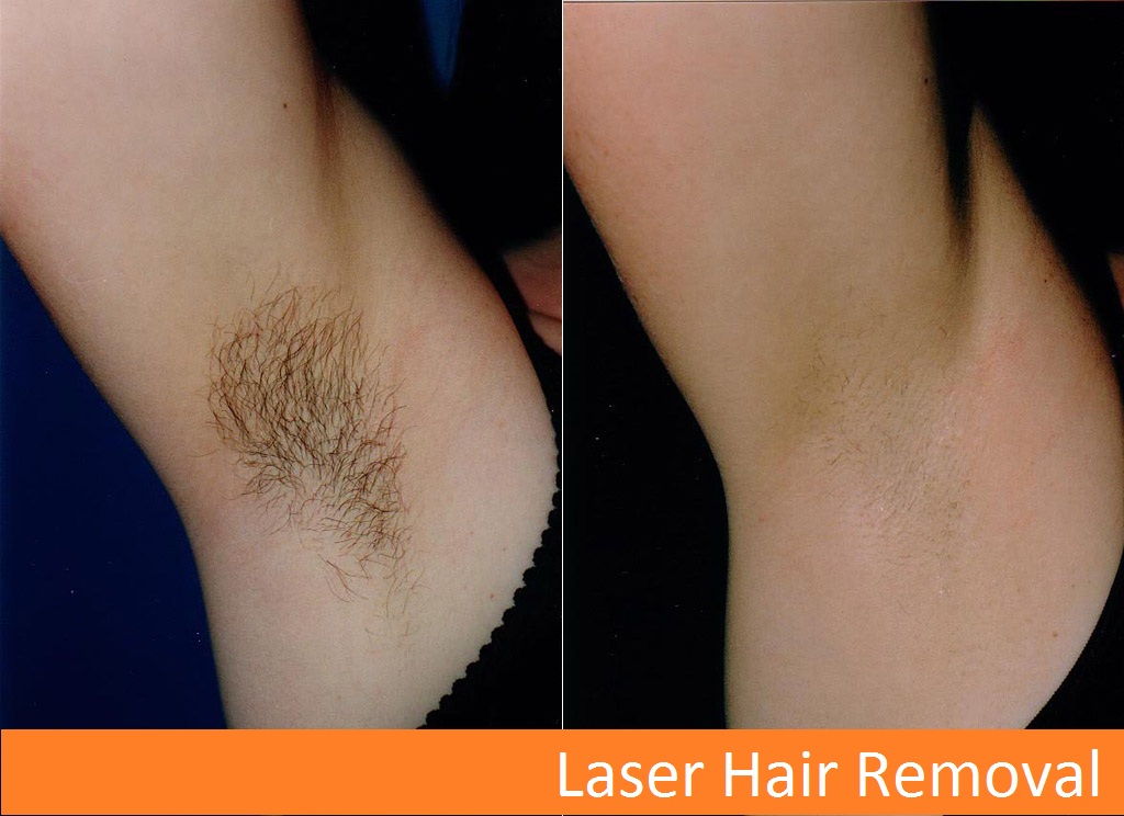 Dr. KULDEEP SINGH SKIN HAIR CLINIC & AMERICAN HAIR TRANSPLANT CLINIC Image 10