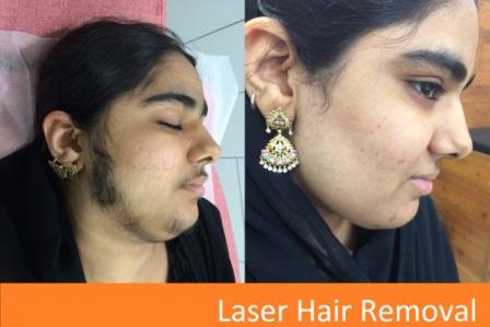 Dr. KULDEEP SINGH SKIN HAIR CLINIC & AMERICAN HAIR TRANSPLANT CLINIC Image 9