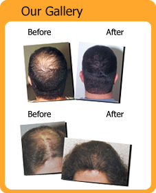 Dr.JosyJoy's online homeopathic consultation and treatment bangalore for thyroid hairfall piles infertility cholesterol skin diabetes ovary cyst irregular periods gastritis arthritis ulsoor bangalore mysore india Image 7