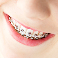 Smile Xpertz Image 5