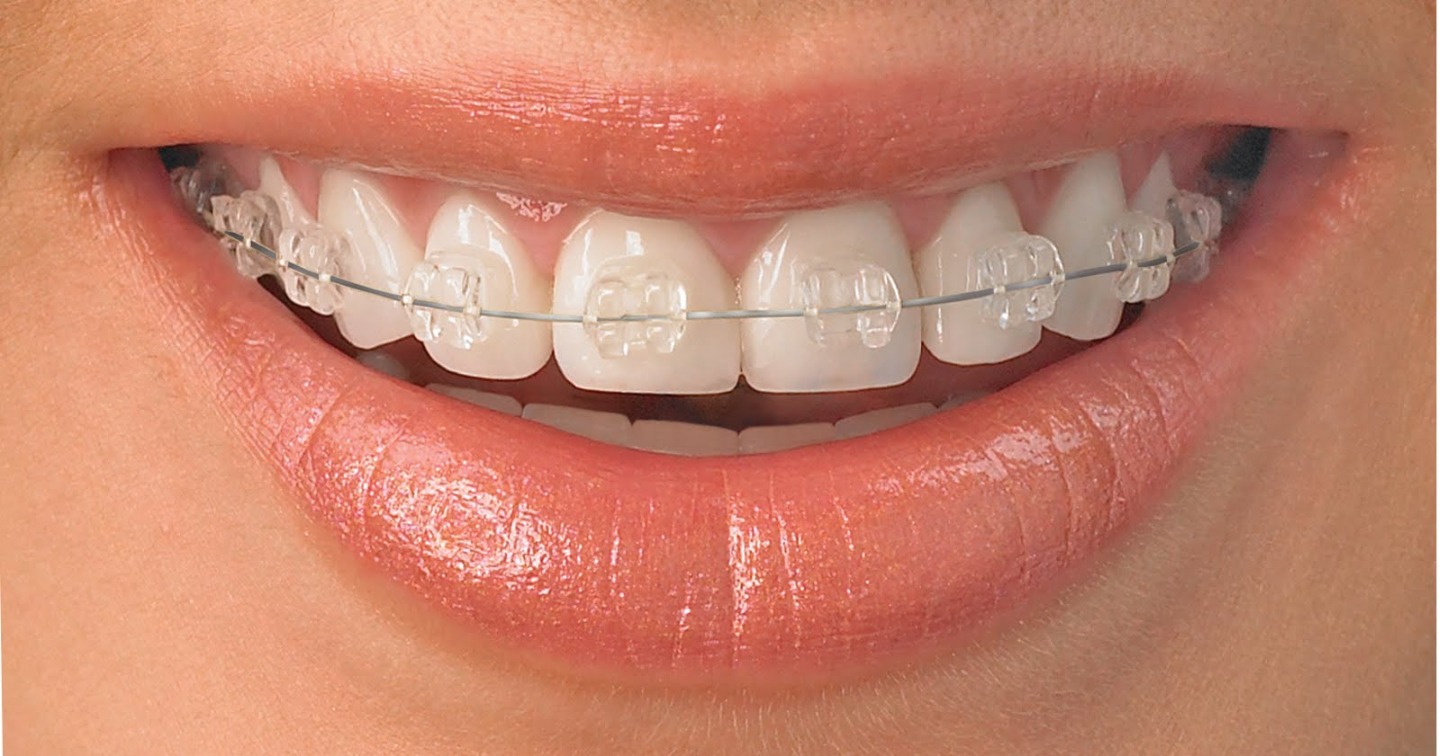 i-Smile Align Dental Clinic Image 2