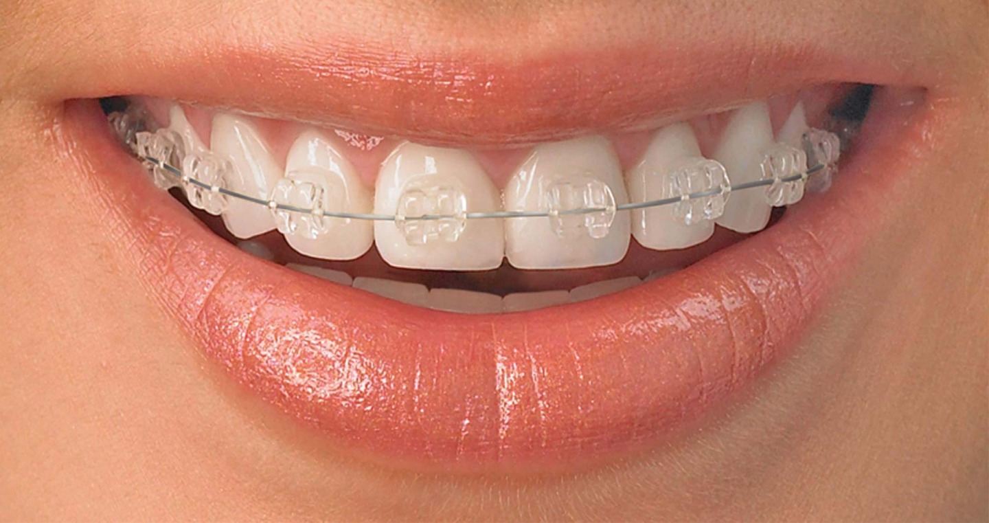 smilecraft dental clinic Image 5