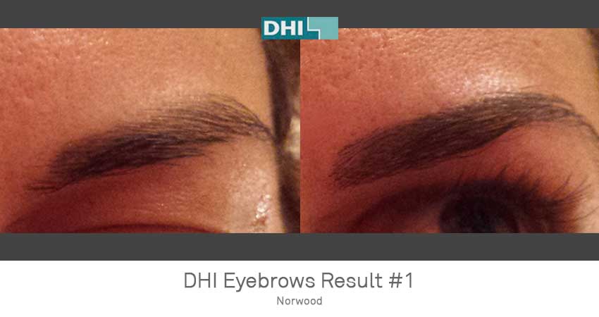 DHI - Delhi Image 5