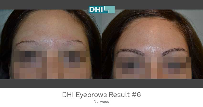 DHI - Delhi Image 8