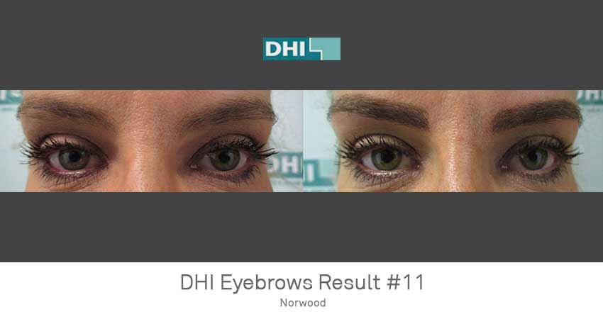 DHI - Delhi Image 7