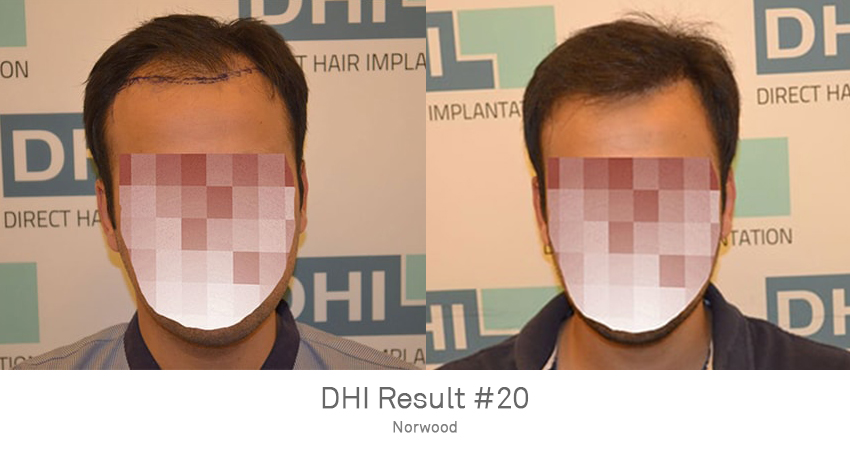 DHI - Gurgaon Image 9