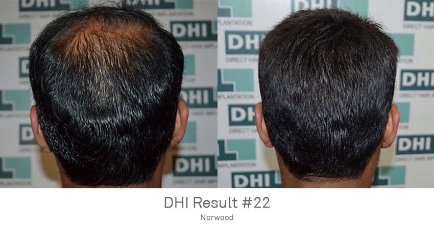 DHI - Gurgaon Image 6