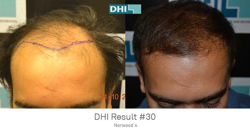 DHI - Gurgaon Image 10