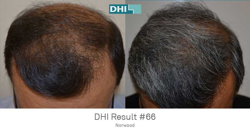 DHI - Gurgaon Image 7