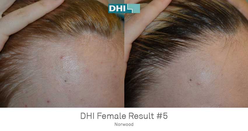 DHI - Bangalore Image 10