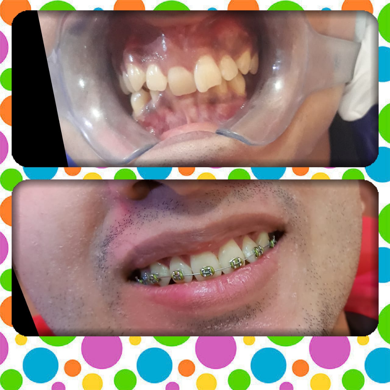 Advance Dental Clinic and Oral Rehabilitation Centre Image 10