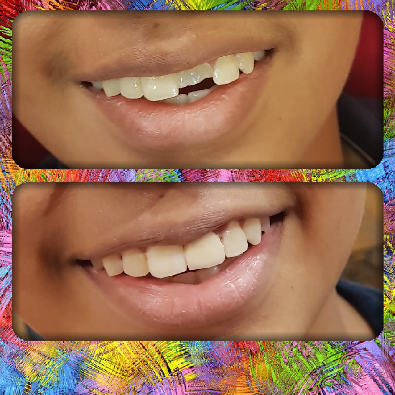 Advance Dental Clinic and Oral Rehabilitation Centre Image 9