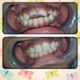 Advance Dental Clinic and Oral Rehabilitation Centre  Image 8
