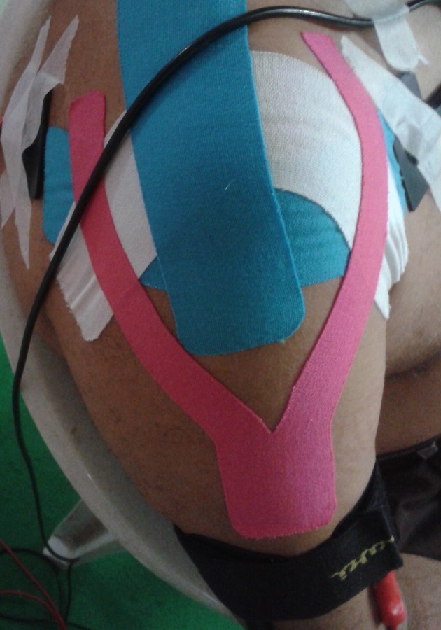 Foster Physio Sports Injury and Pain Clinic Image 4