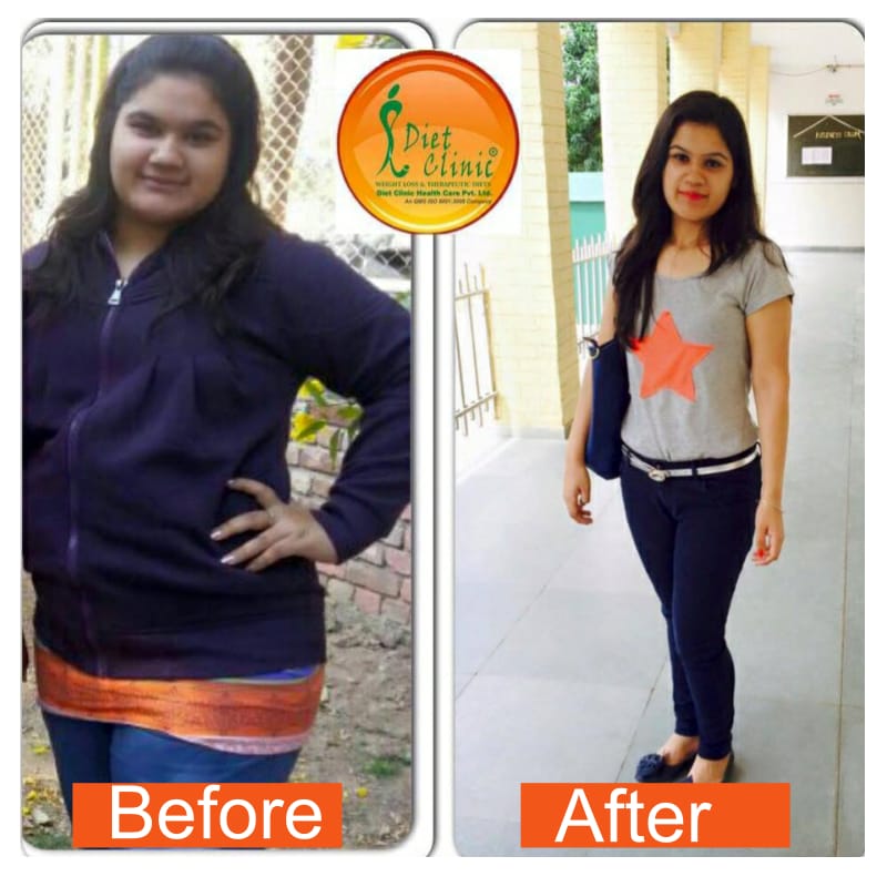 Diet Clinic - Hissar Image 7