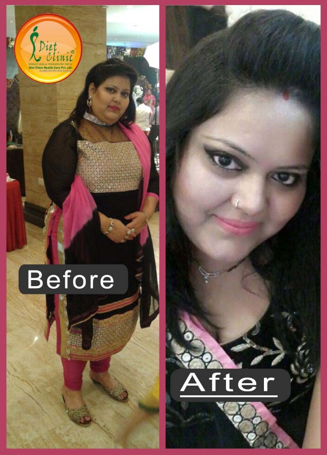 Diet Clinic - Hissar Image 6