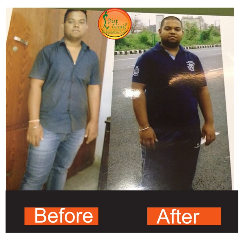 Diet Clinic - Yamuna Nagar Image 8