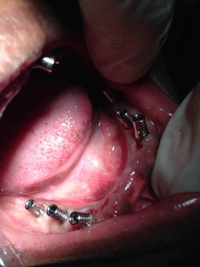 Dhanwanth Dental Care & Implant Center Image 10