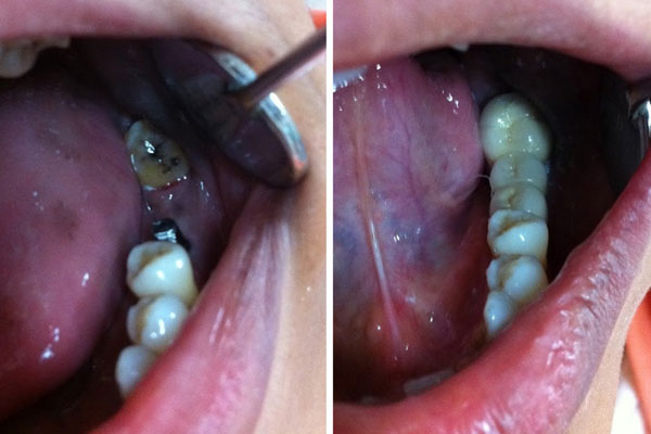 Dhanwanth Dental Care & Implant Center Image 3
