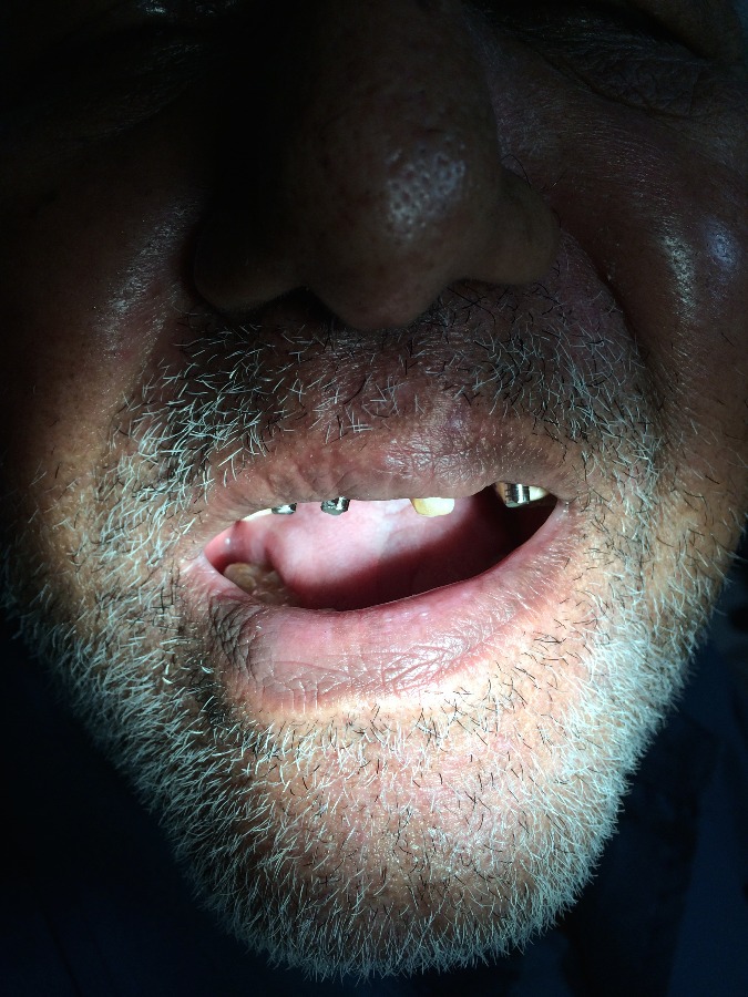 Dhanwanth Dental Care & Implant Center Image 8
