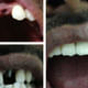 Dhanwanth Dental Care & Implant Center Image 5