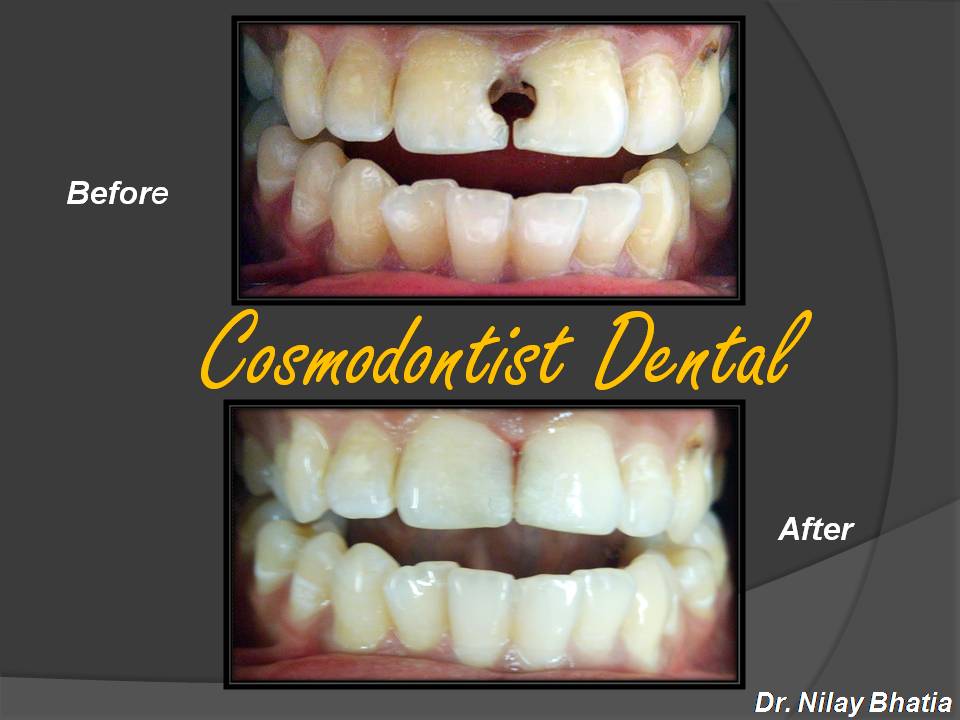 Cosmodontist Dental & Implant Centre Image 3