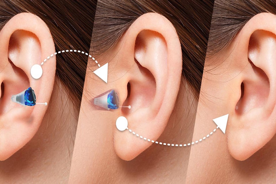 A1 Hearing Aid & Speech therapy Centre Image 2