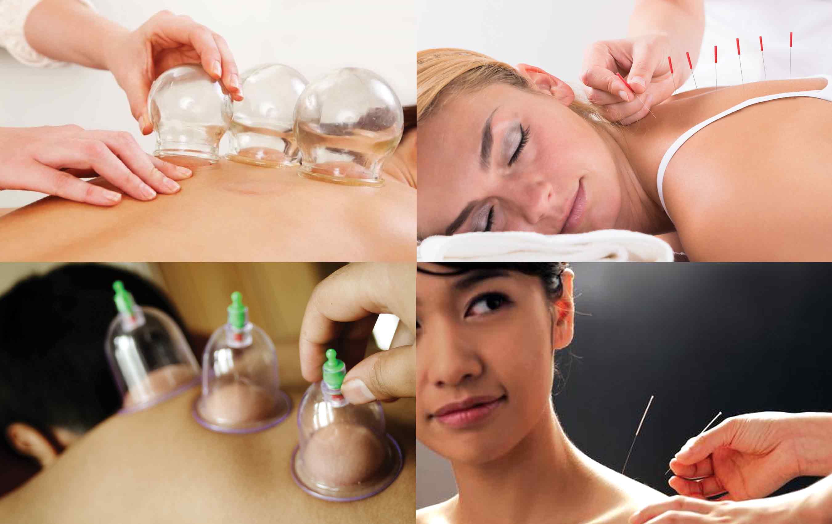 Aura Acupuncture,Hijama,Yoga & Natural Medicine Clinic Image 3