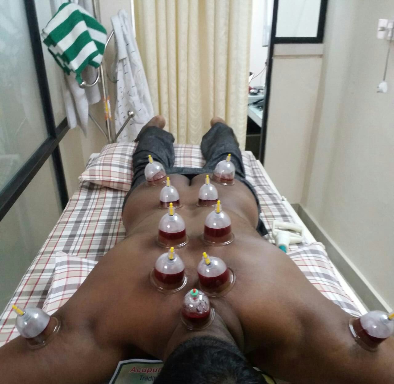 Aura Acupuncture,Hijama,Yoga & Natural Medicine Clinic Image 10